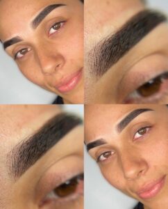 Temporal Brows (1)