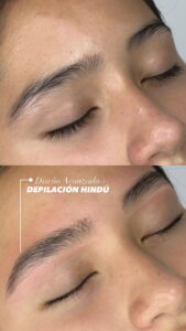 Temporal Brows (2)